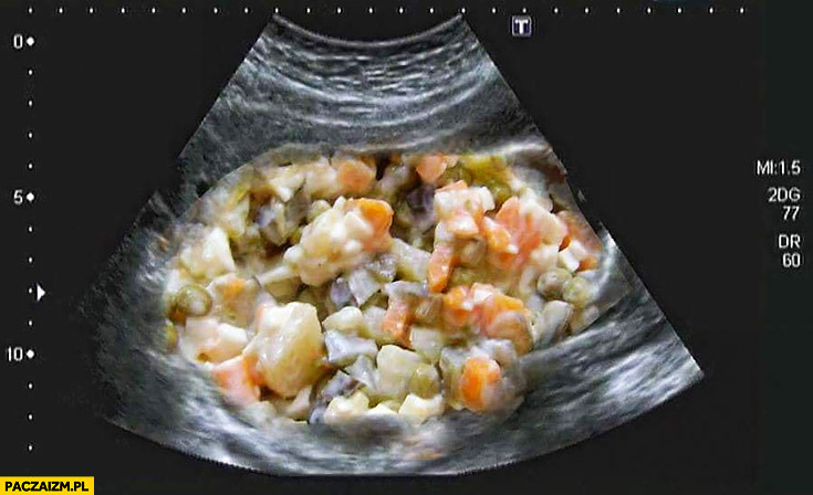 Badanie USG brzucha sałatka warzywna z majonezem prześwietlenie rentgen