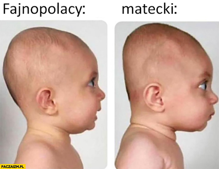 Fajnopolacy vs Matecki dziecko niedorozwój
