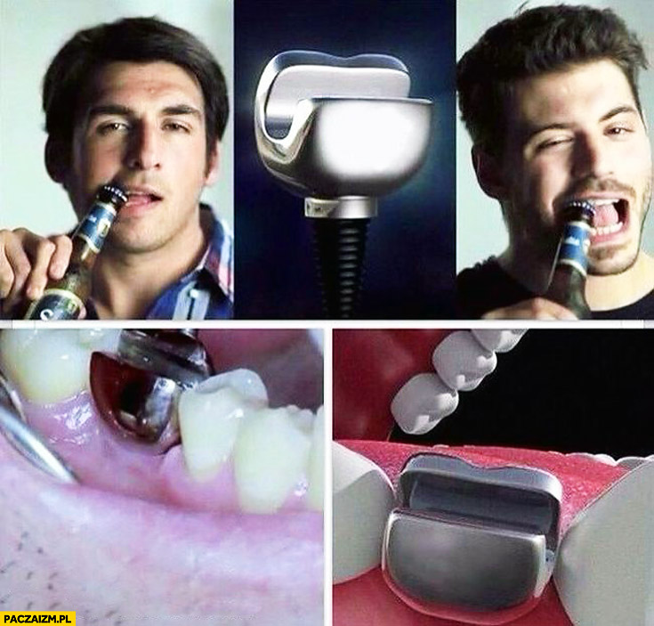 Metalowy implant zęba otwieracz do butelek